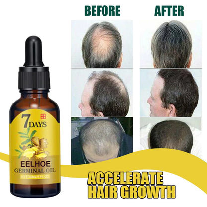 Hair Growth Serum 7 Days Fast Hair Growth Essential Oils