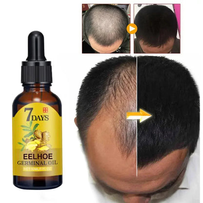 Hair Growth Serum 7 Days Fast Hair Growth Essential Oils