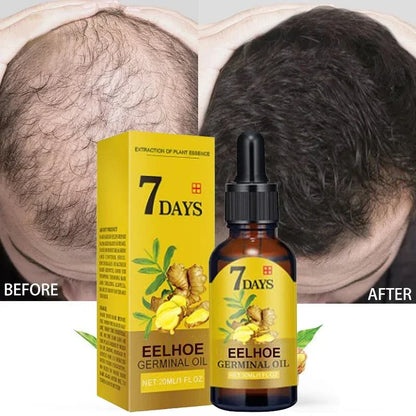 Hair Growth Serum 7 Days Fast Hair Growth Essential Oils